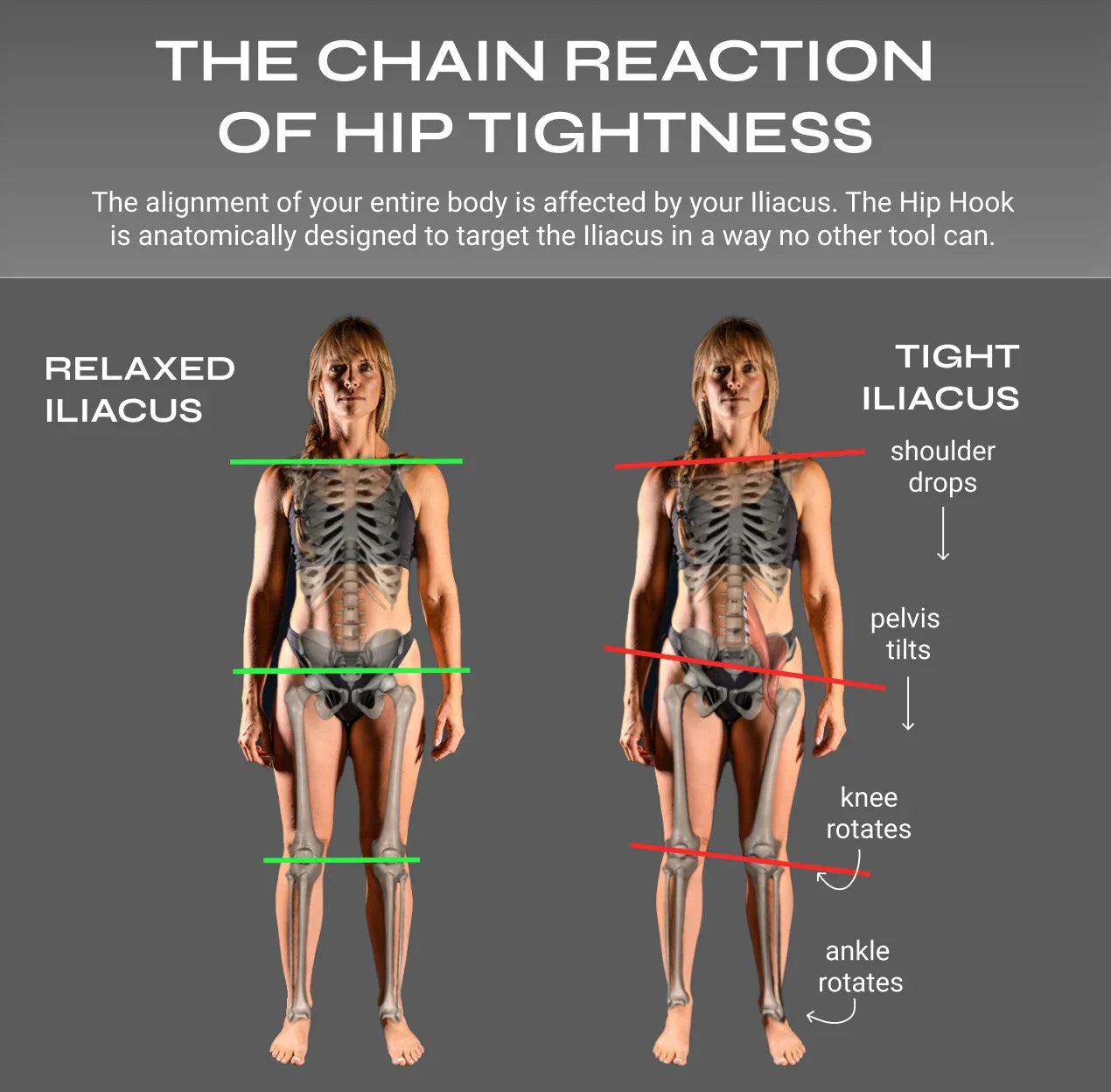 Full Body System
